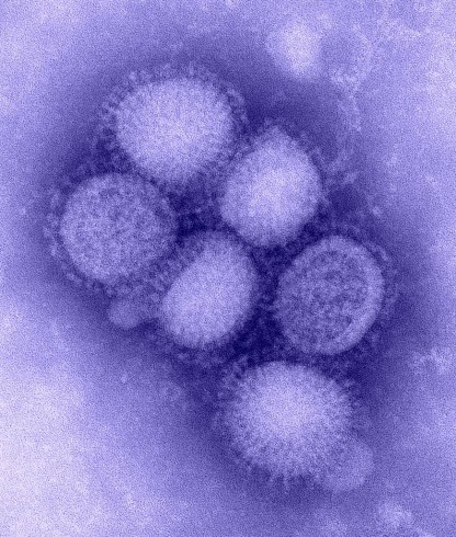 H1N1_influenza_virus_CClicense